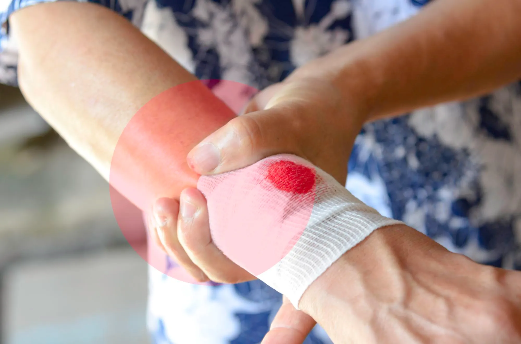 Soft Tissue