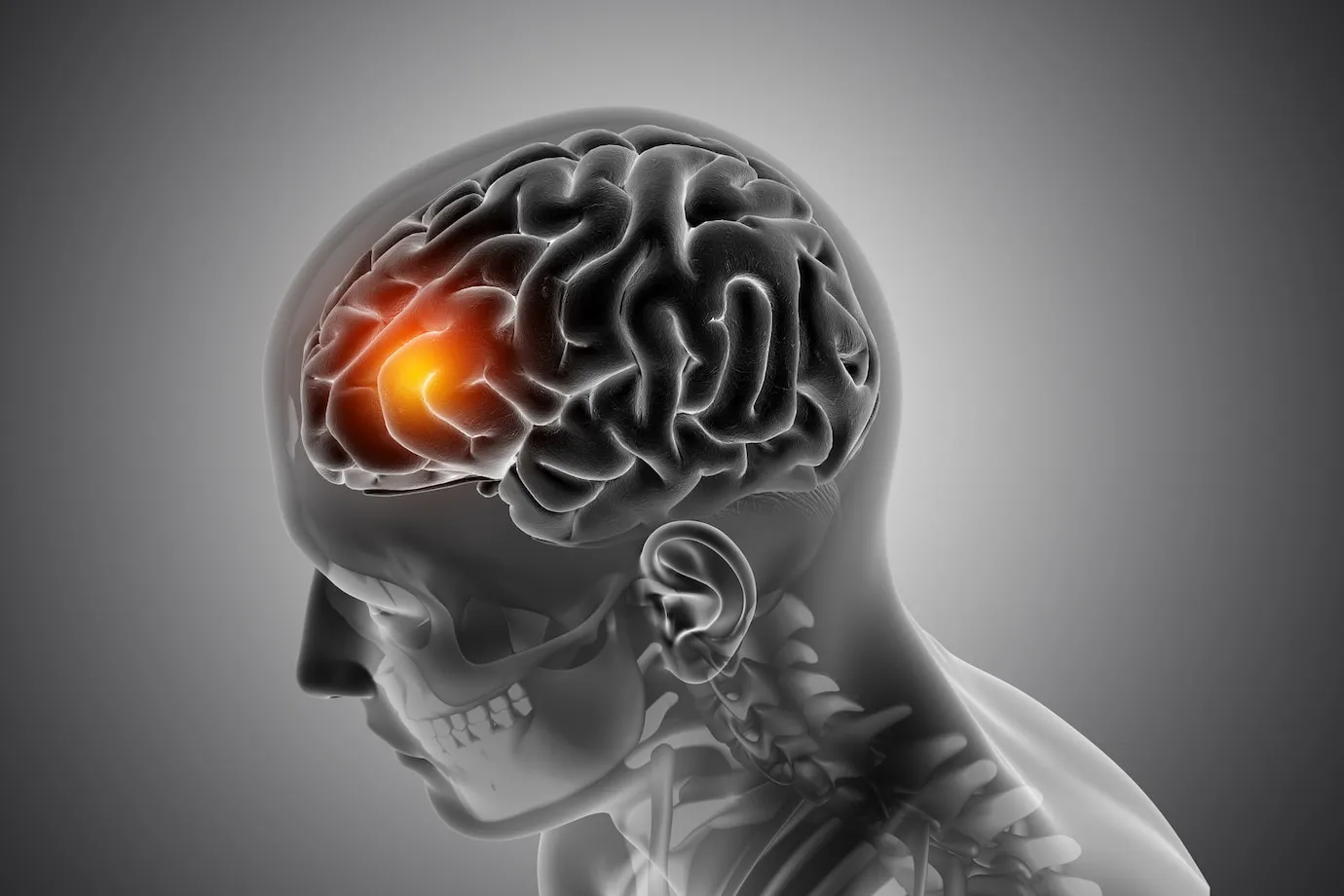 Traumatic Brain Injury